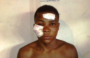 Araci: estuprador abusa de criança de 6 anos e é espancado por populares