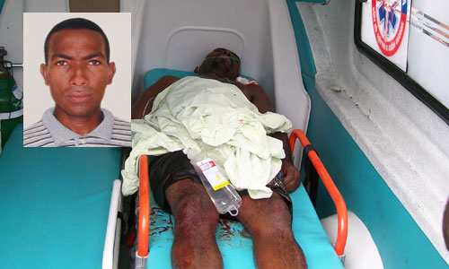 Coité: magarefe recebe facada e é transferido em estado gravíssimo