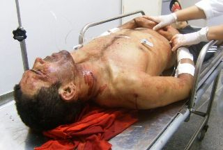 Cabeleireiro é baleado momento em que fechava sua barbearia em Serrinha