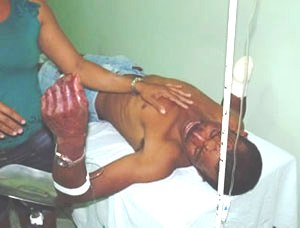 Homem tem mão decepada durante briga