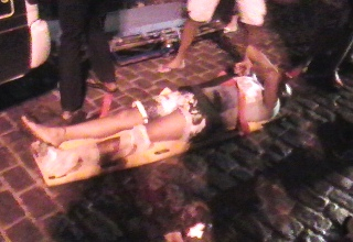 Motociclista sofre ferimentos graves na perna ao colidir com carro