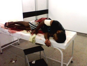 Dois casos de tentativa de homicídio movimentou a polícia e o Hospital Almir Passos