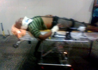 Garçom dá entrada no HGE em estado grave, depois de sofrer acidente de moto em Coité