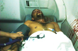 Serrinha: motocilista que bateu em cavalo na BR 116 continua internado no HGE