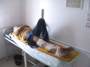 Comerciante bate moto Bis em porta de carro e na queda fratura a perna