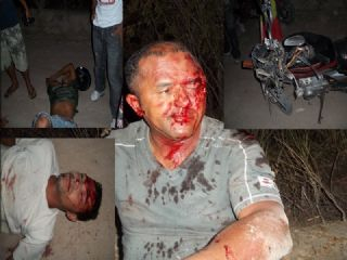 Motorista de ambulância de Quijingue morre seis dias depois de se envolver em acidente de moto