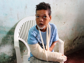 Garoto que caiu de uma altura de 20 metros em Coité recebeu alta e já está em casa