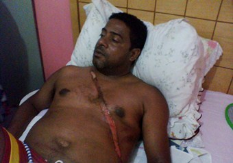 Carona do Pálio de Coité envolvido em acidente na BR 324 já recebeu alta