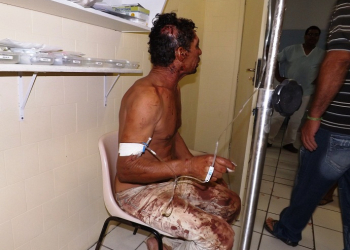 Idoso é agredido a pauladas em tentativa de roubo