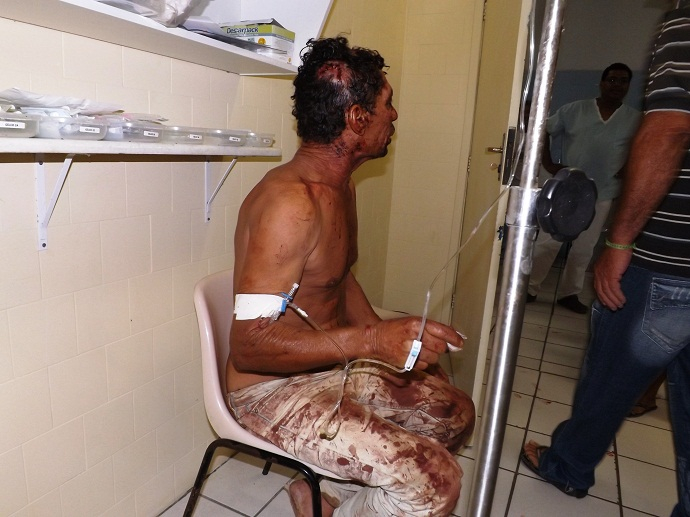 Idoso é agredido a pauladas em tentativa de roubo