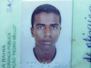 Coité – Homem é transferido depois de atear fogo no próprio corpo