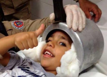Dia de ‘Menino Maluquinho’: criança prende cabeça em panela de pressão