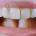 Cientistas chineses recriam dentes a partir do uso de urina humana