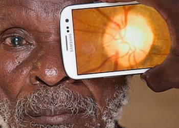 Aplicativo faz ‘exame de vista’ pelo celular; invento é testado na África