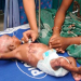Na Índia, bebê de três meses pega fogo pela quarta vez por conta de doença rara