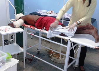 Jovem recebe vários golpes de facão na zona rural de Conceição do Coité