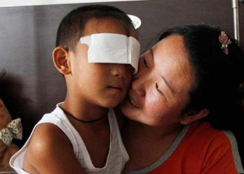 China: Criança que teve os olhos arrancados poderá voltar a enxergar