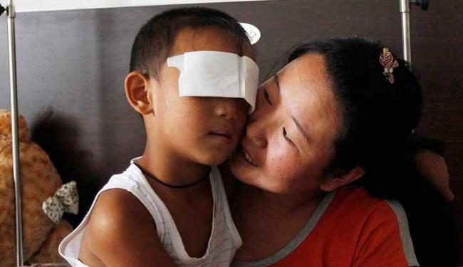 China: Criança que teve os olhos arrancados poderá voltar a enxergar