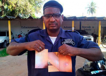 Mulher queima testículos de guarda com panela de arroz quente