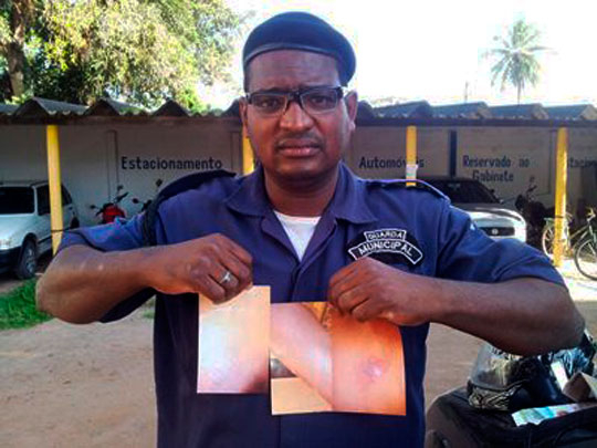 Mulher queima testículos de guarda com panela de arroz quente