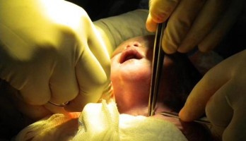 Intervenção cirúrgica pouco comum obteve sucesso mesmo antes da data programada