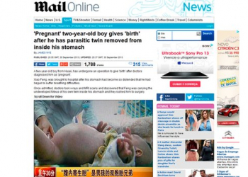 Bebê “grávido” de gêmeo é operado na China