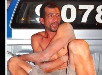 Mulher que teve orelha desfigurada pelo marido é examinada