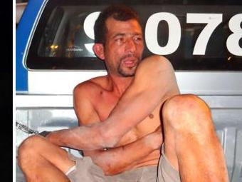 Mulher que teve orelha desfigurada pelo marido é examinada