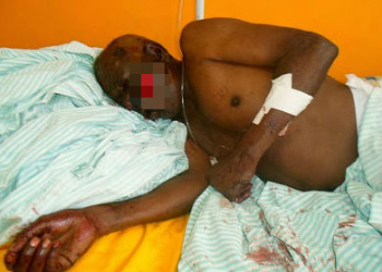 Idoso tem casa invadida por adolescente e é esfaqueado 13 vezes