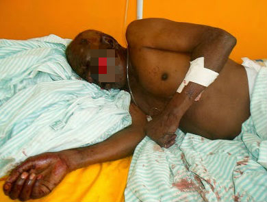 Idoso tem casa invadida por adolescente e é esfaqueado 13 vezes