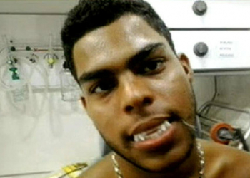 Jovem costura dentadura de plástico na boca pra ficar parecido com vampiro e é levado para hospital
