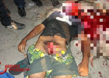 Morador de rua tem o pênis arrancado e morre