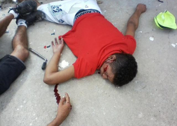 Jovens ficam gravemente feridos depois de moto bater em parede de casa