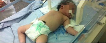 bebe-estadograve-fotoreproducapo