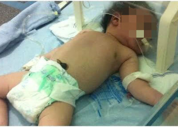 Bahia: defensoria bloqueia bens do Estado por não transferir bebê em estado grave