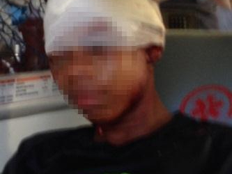 Jovem é espancado por traficantes durante acerto de contas