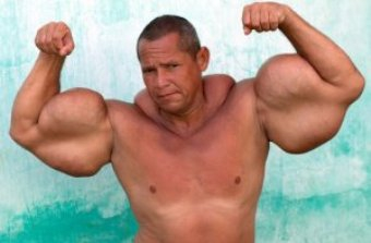 Homem injeta óleo mineral e álcool nos braços e vira ‘Popeye da vida real’