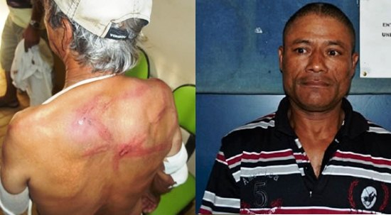 Homem “desconta” surra que levou há 30 anos