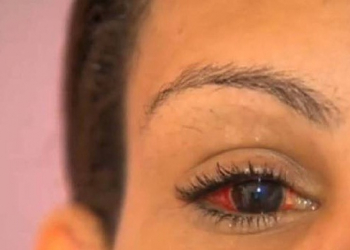 Após ser dada como morta, mulher acorda e denuncia autora