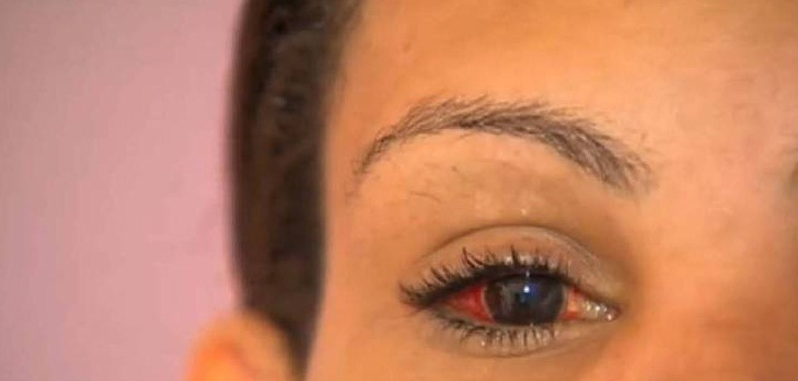 Após ser dada como morta, mulher acorda e denuncia autora