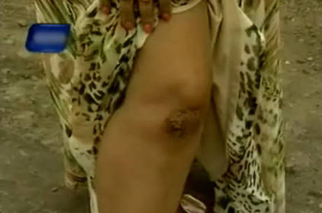 Empregada doméstica é agredida por patroa após ser acusada de roubo