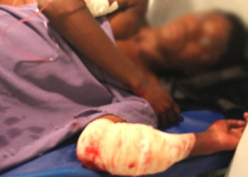 Coité – Mais um menor sofre tentativa de homicídio no quarto dia seguido