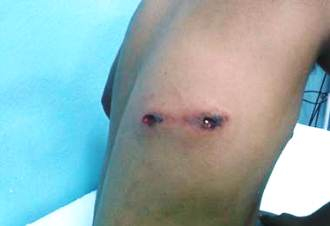 Jovem de 18 anos sofre tentativa de homicídio na zona rural