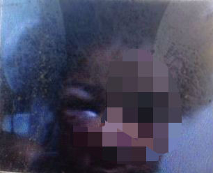 Criança de 5 anos é espancada em Portão, Padrasto e mãe são suspeitos