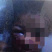 Criança de 5 anos é espancada em Portão, Padrasto e mãe são suspeitos
