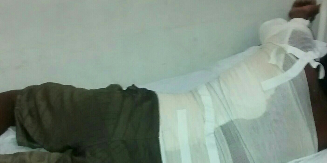 Homem joga gasolina e ateia fogo em amigo na zona rural