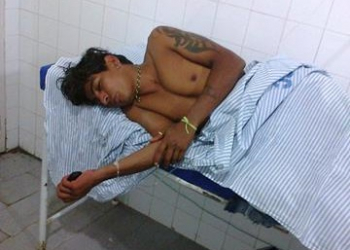 Homens baleados em Caldas do Jorro dão entrada no Hospital de Araci