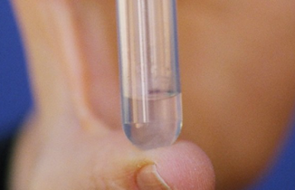  Medicamento em gel não envolve tratamento hormonal e pode ser revertido.