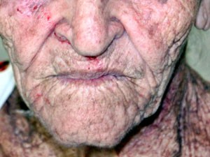 Homem é preso suspeito de agredir idosa de 84 anos