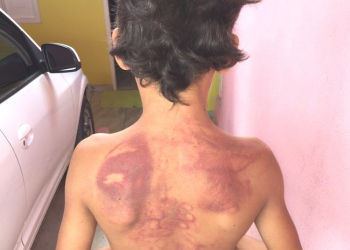 Homem é preso após agredir enteado com chineladas